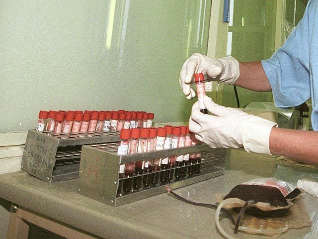 Эпидемия ВИЧ в 20 регионах России достигла высшей стадии