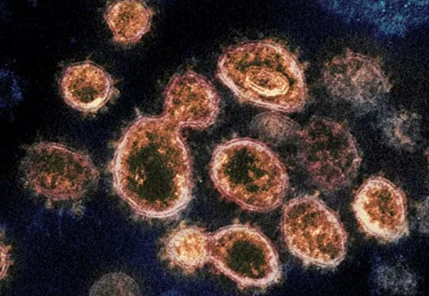 Ученые нашли ещё один способ лечения коронавируса