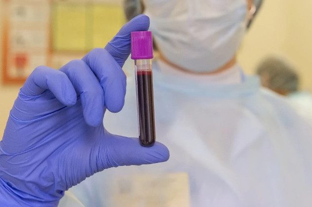Инфекционист назвал тесты на антитела к коронавирусу пустой тратой денег