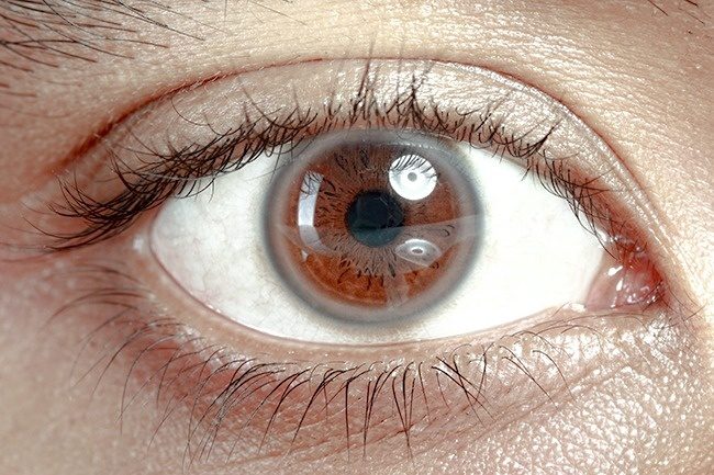 Что могут рассказать глаза о вашем здоровье