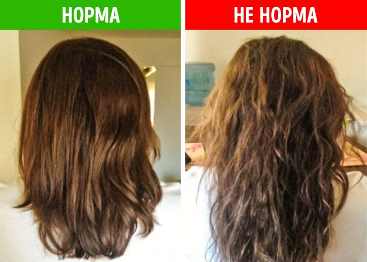 Что состояние волос расскажет о вашем здоровье