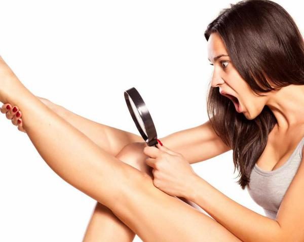 Как быстро уменьшить раздражение после бритья ног