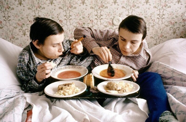 Жизнь и страдание самых известных сиамских близнецов СССР