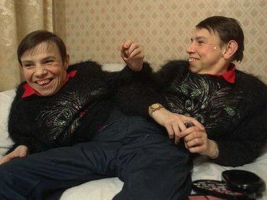 Самые известные сиамские близнецы Советского Союза