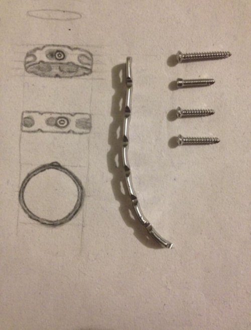 Кольцо из металлической пластины, вырезанной из плеча