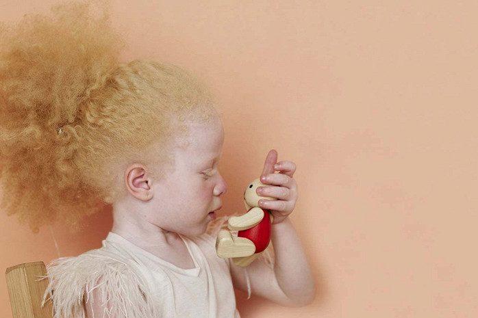 Почему появляются на свет дети-альбиносы?