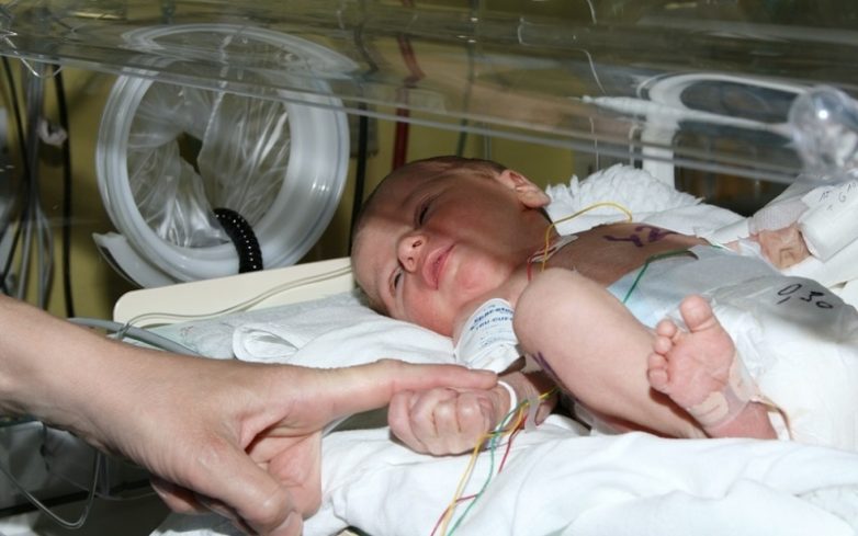 Смертность среди недоношенных детей заметно снизилась