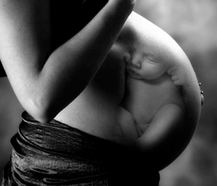 Маловодие и многоводие у беременных