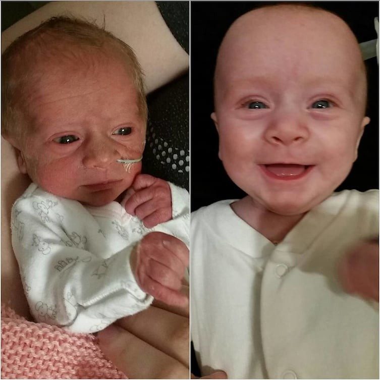 13 улыбающихся младенцев, которые родились раньше срока и выжили