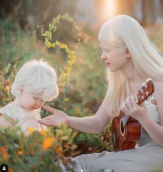 Сестры-альбиносы из Казахстана стали звездами соцсетей