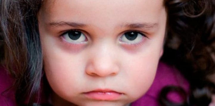 Почему у детей бывают тёмные круги под глазами?