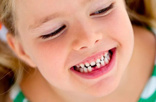 Что нужно есть ребёнку, чтобы не ходить к стоматологу?
