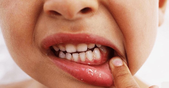 Первая помощь ребенку при проблемах с зубами