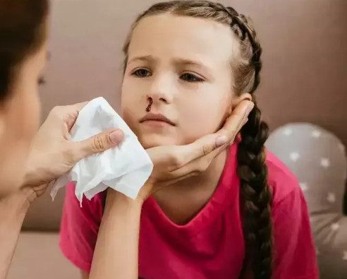 Опасны ли кровотечения из носа у детей?
