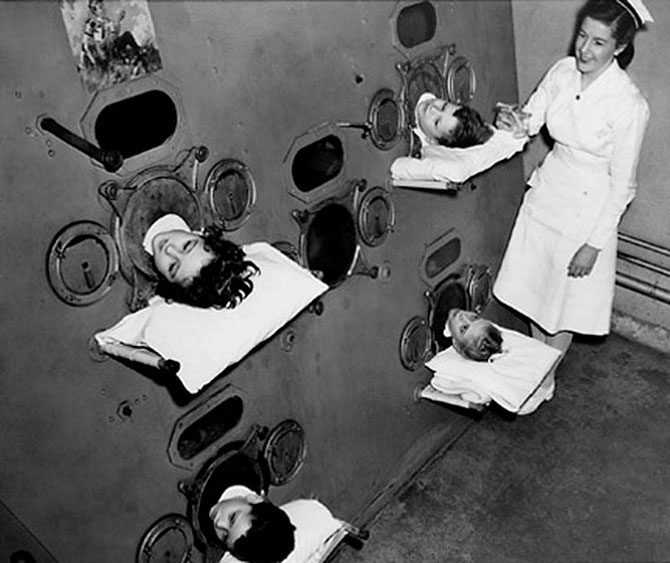 Интригующе и пугающе: медицина прошлого в фотографиях
