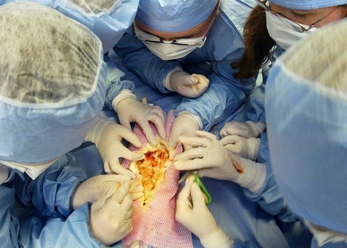 Невероятные последствия хирургических операций