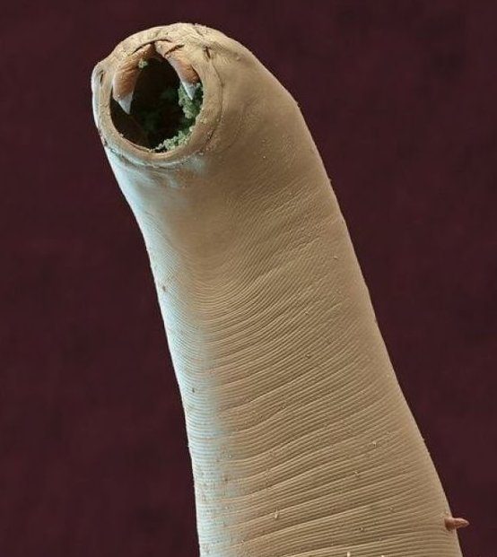 Страсти-мордасти: фото реальных существ под микроскопом, которые страшнее любого монстра из ужастиков