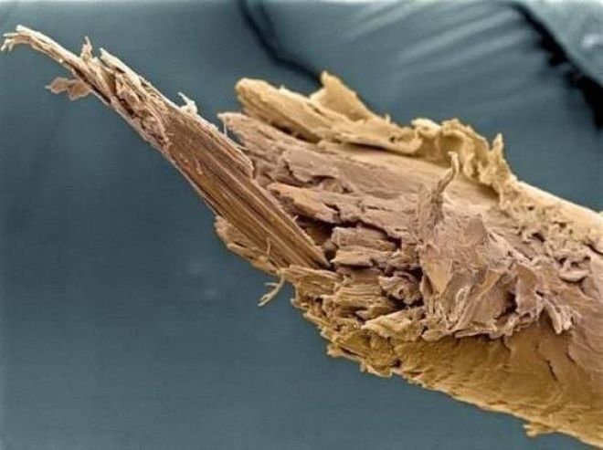 Как выглядит наше тело под микроскопом