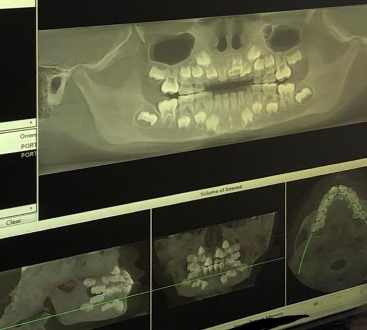15 впечатляющих рентгеновских снимков, показывающих мир с новой стороны