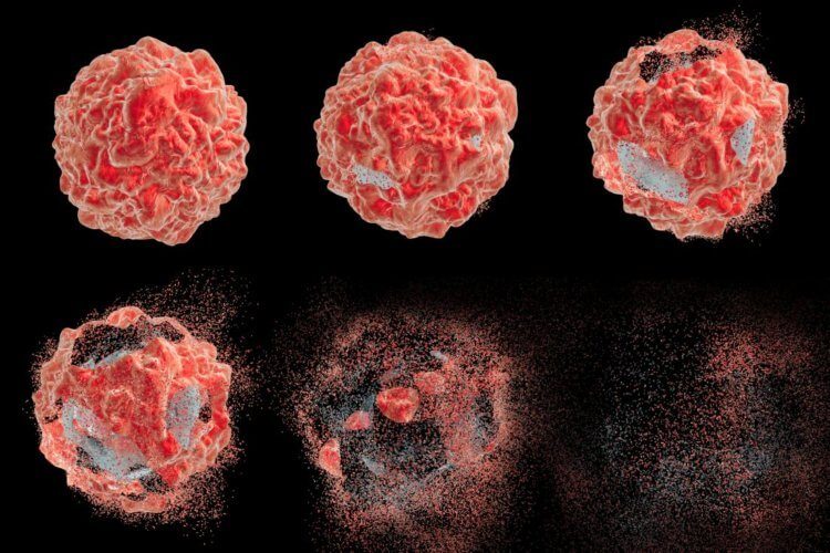Шотландские учёные изобрели новый способ уничтожения раковых клеток