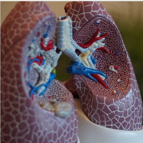 Всё, что нужно знать о раке лёгкого