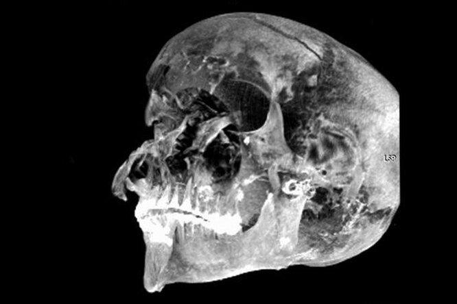 Исследователи с помощью томографа выяснили, как погиб египетский фараон