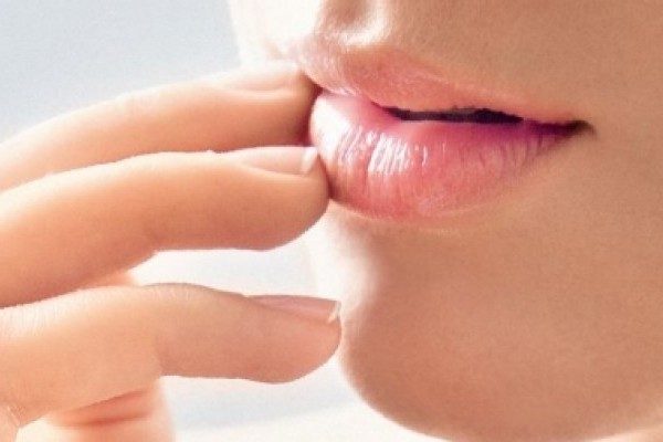 Как лечить заеды в уголках рта