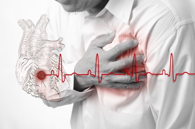 Инфаркт: 10 факторов риска, которые должен знать каждый