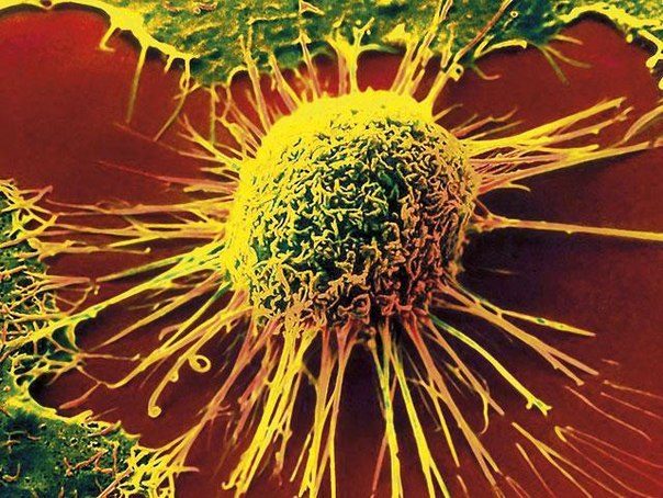 Революция в онкологии: рак удаётся полностью излечить!