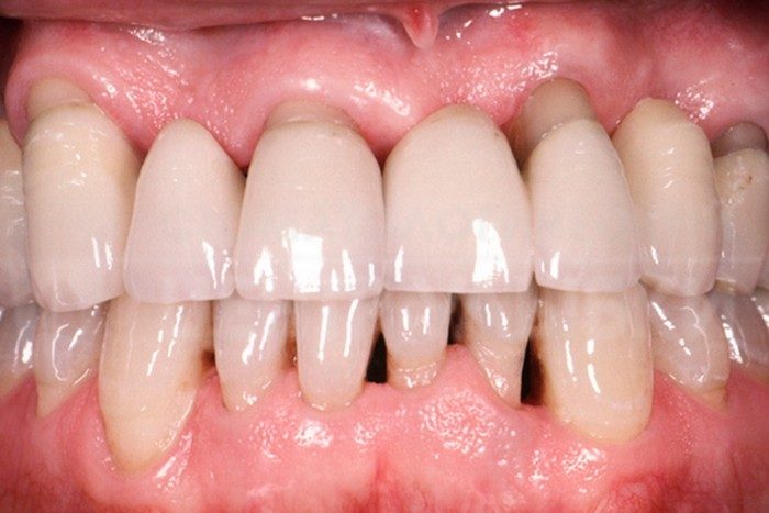 15 веских причин чистить зубы