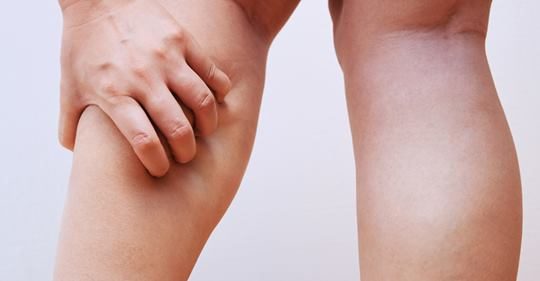 4 причины, из-за которых бывают судороги ног