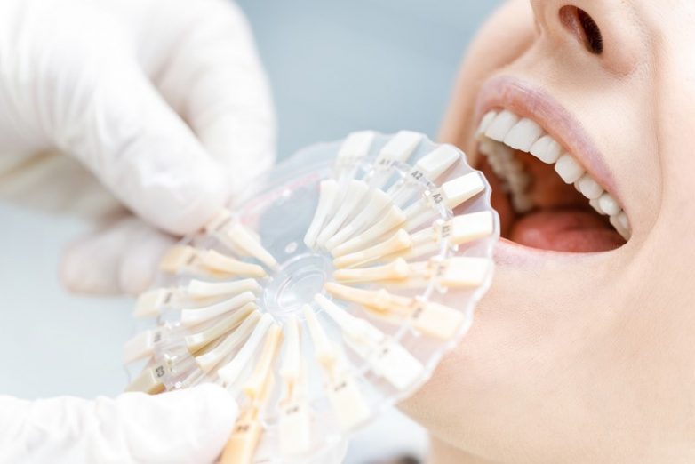 6 приёмов, которыми пользуются недобросовестные стоматологи