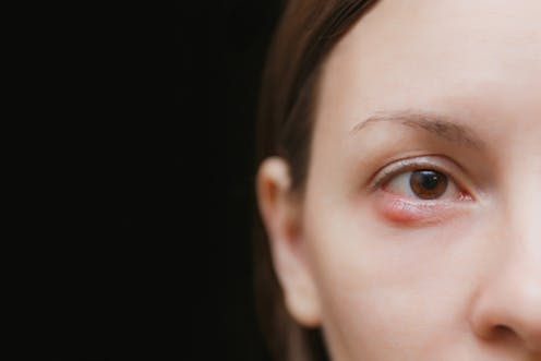 Что глаза могут рассказать о нашем здоровье