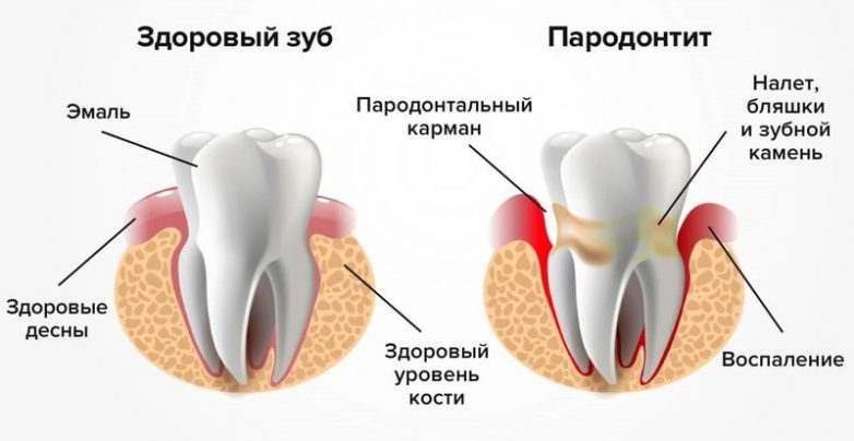 Как сохранить здоровье зубов до старости