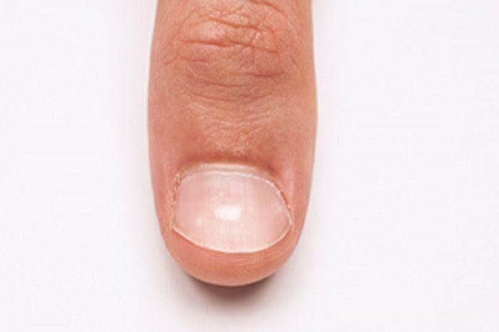 Что ногти расскажут о вашем здоровье