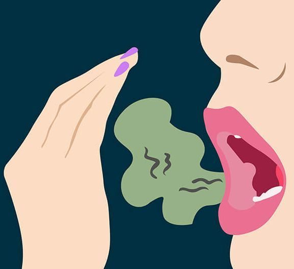 Как избавиться от хронического неприятного запаха изо рта