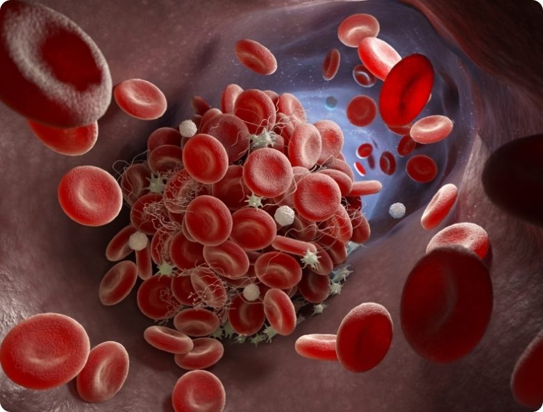 Как тромбоциты влияют на атеросклероз
