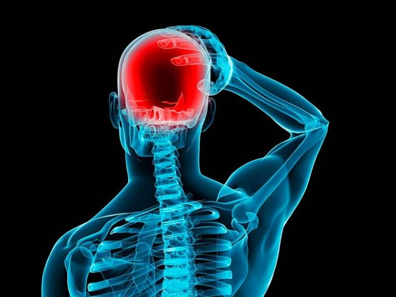 Советы, как избавиться от головной боли, вызванной повышением внутричерепного давления