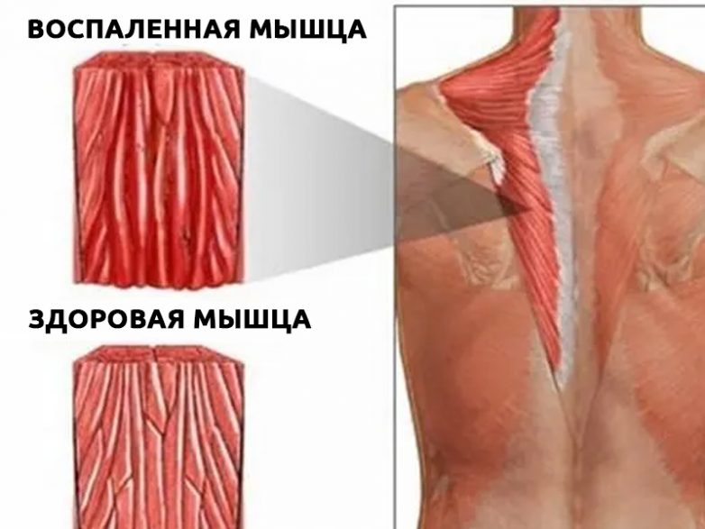 Продукты, которые спасут от боли в мышцах после тренировки