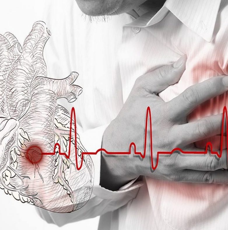Что делать при приступе инфаркта миокарда