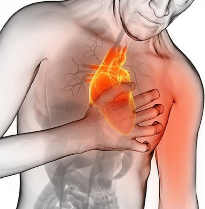 Что делать при приступе инфаркта миокарда