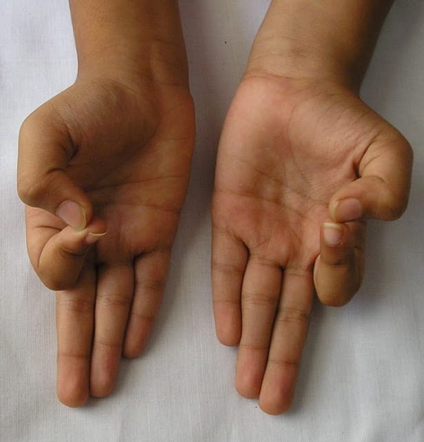 8 жестов рук (мудр), которые стимулируют ваше тело