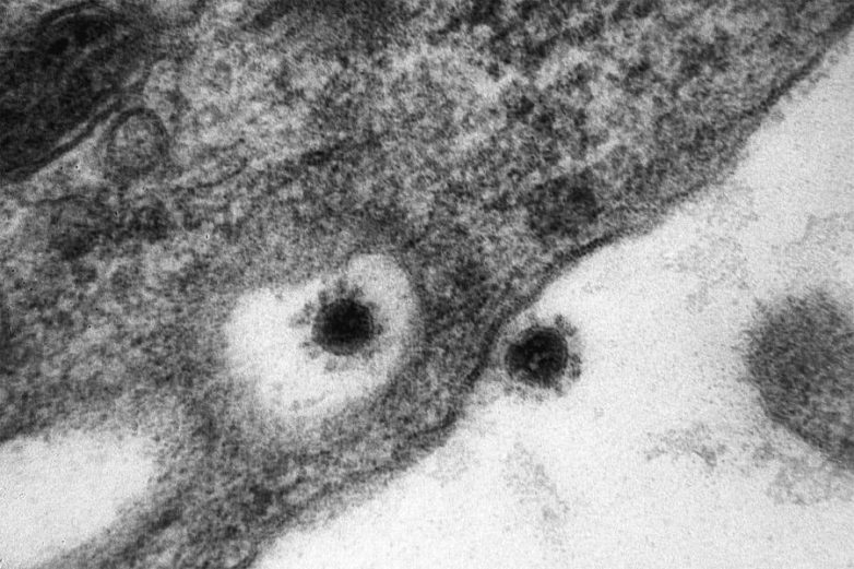 Было опубликовано фото дельта-штамма коронавируса
