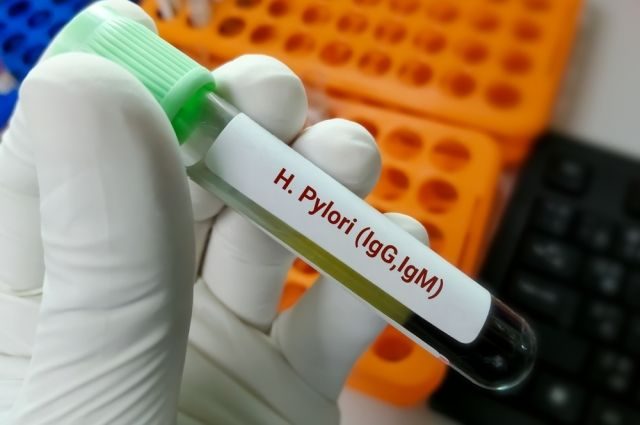 Что надо знать о Helicobacter pylori