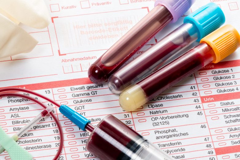 Как расшифровать в анализе крови показатели базофилов?