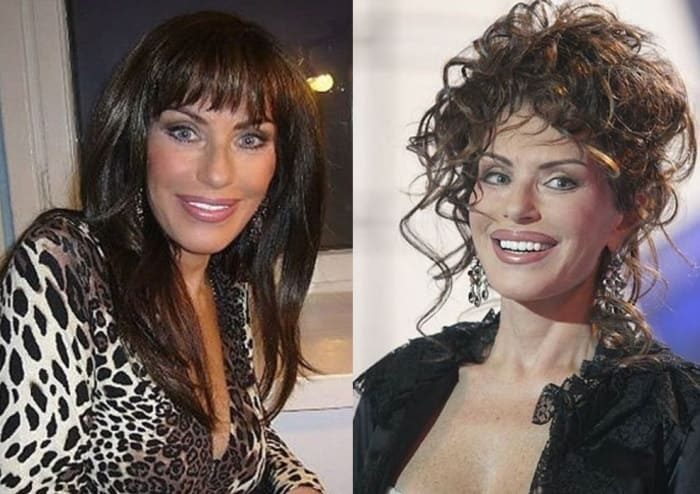 Ирина понаровская пластика лица до и после фото биография