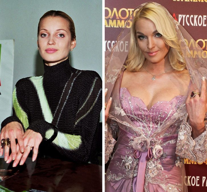 Российские знаменитости, которые со временем будто превратились в других людей