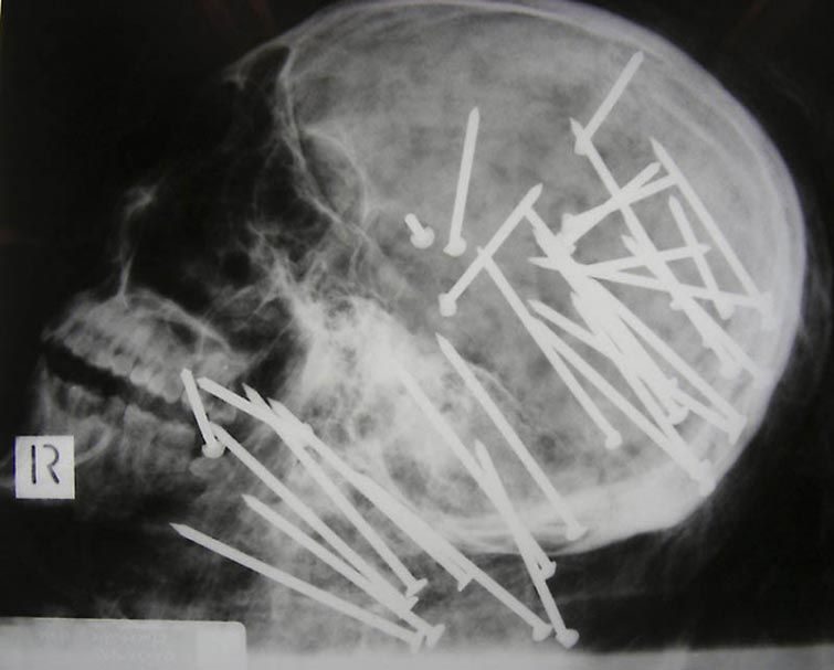 5 самых любопытных рентгеновских снимков за всю историю