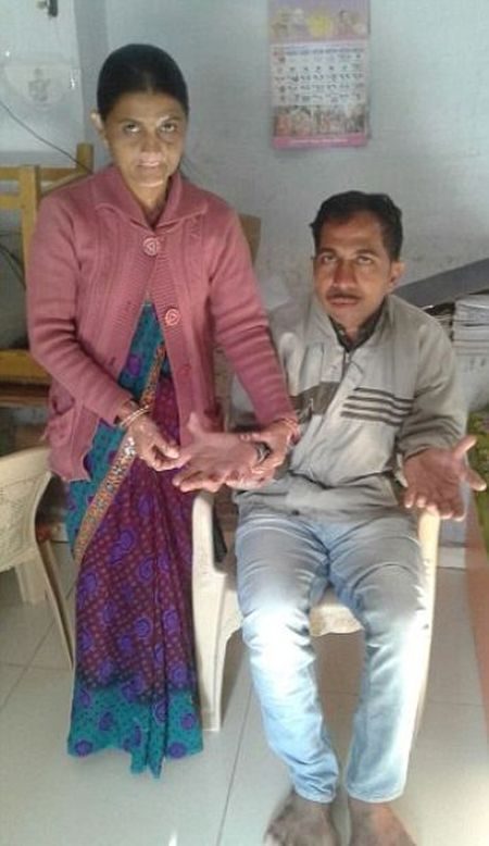 Этот индиец - рекордсмен мира по количеству пальцев на руках и ногах