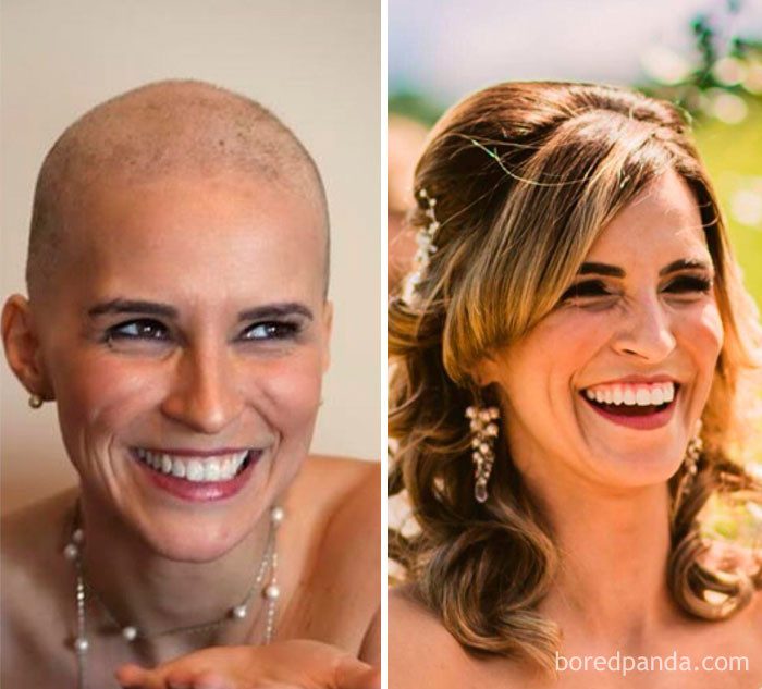Люди, победившие рак. До и После